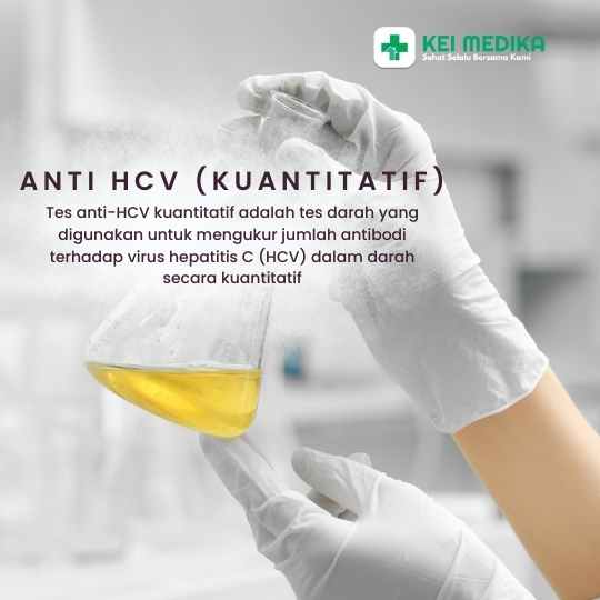 ANTI HCV (KUANTITATIF)