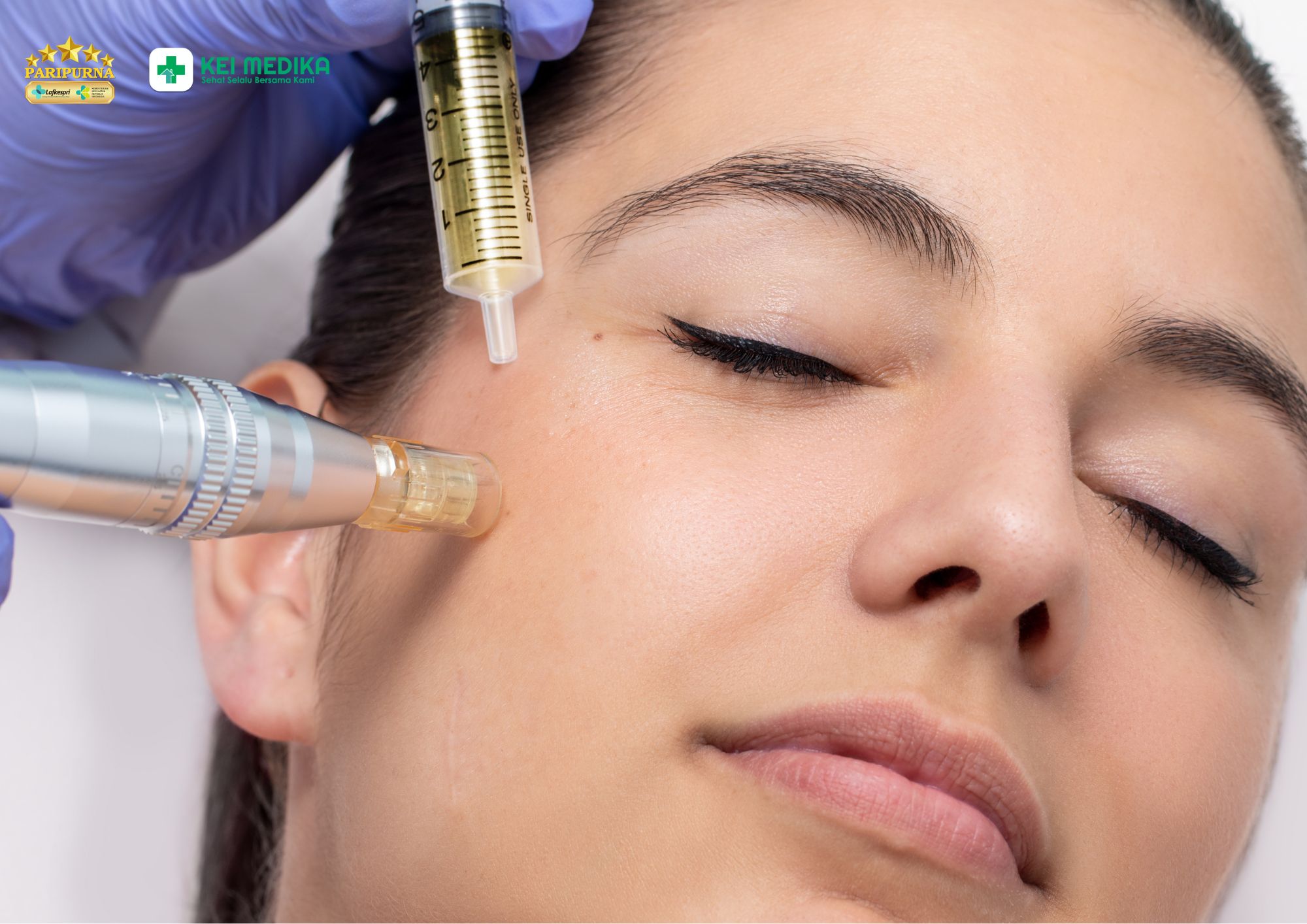 Manfaat PRP dengan derma untuk kulit sensitif di klinik kei medika aesthetic jambi
