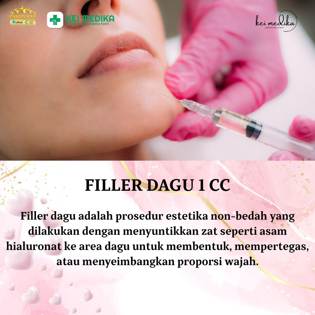 FILLER DAGU 1 CC
