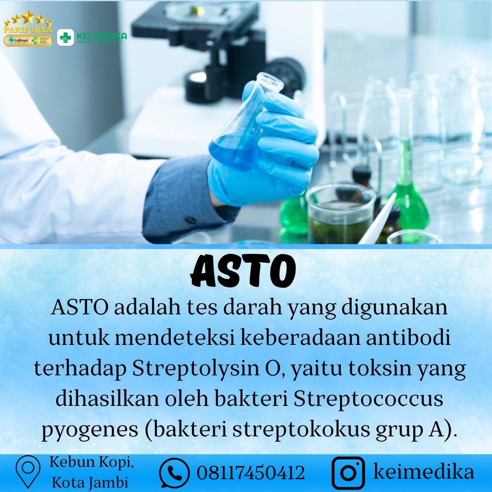 ASTO