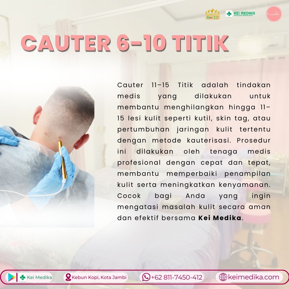 CAUTER 6-10 TITIK