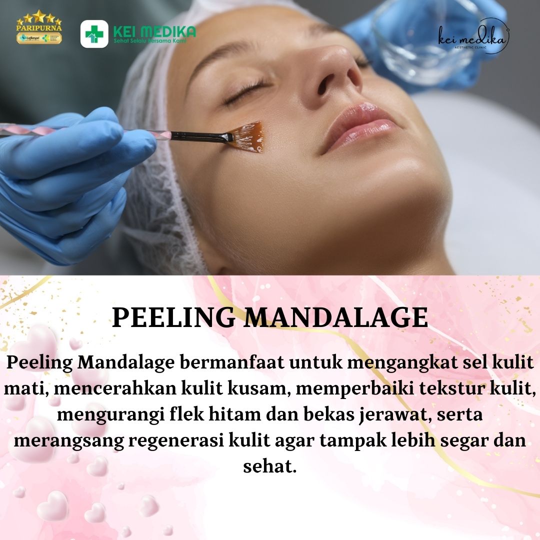 PEELING MANDELAGE