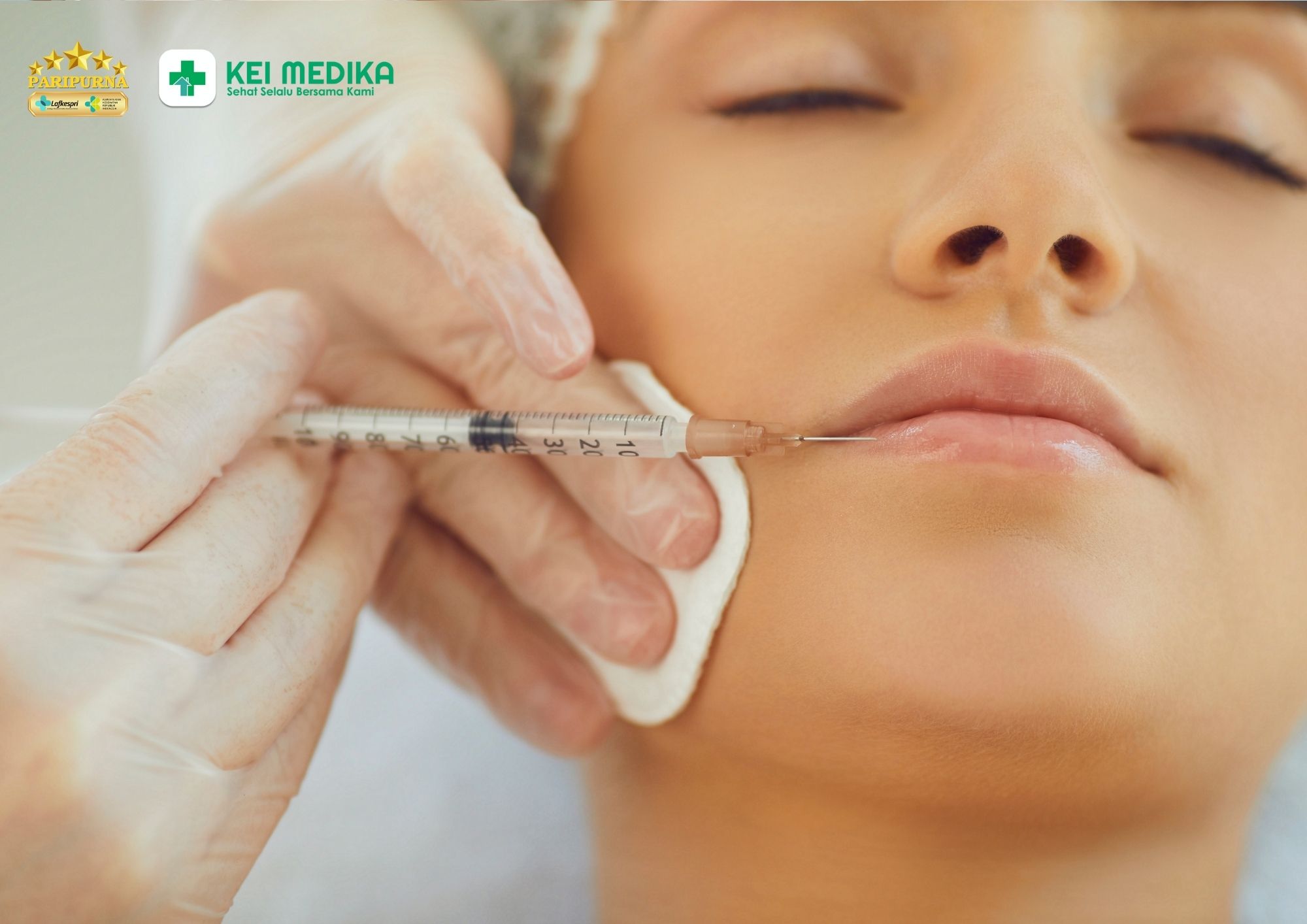 Botox dan filler dalam satu sesi, apakah aman