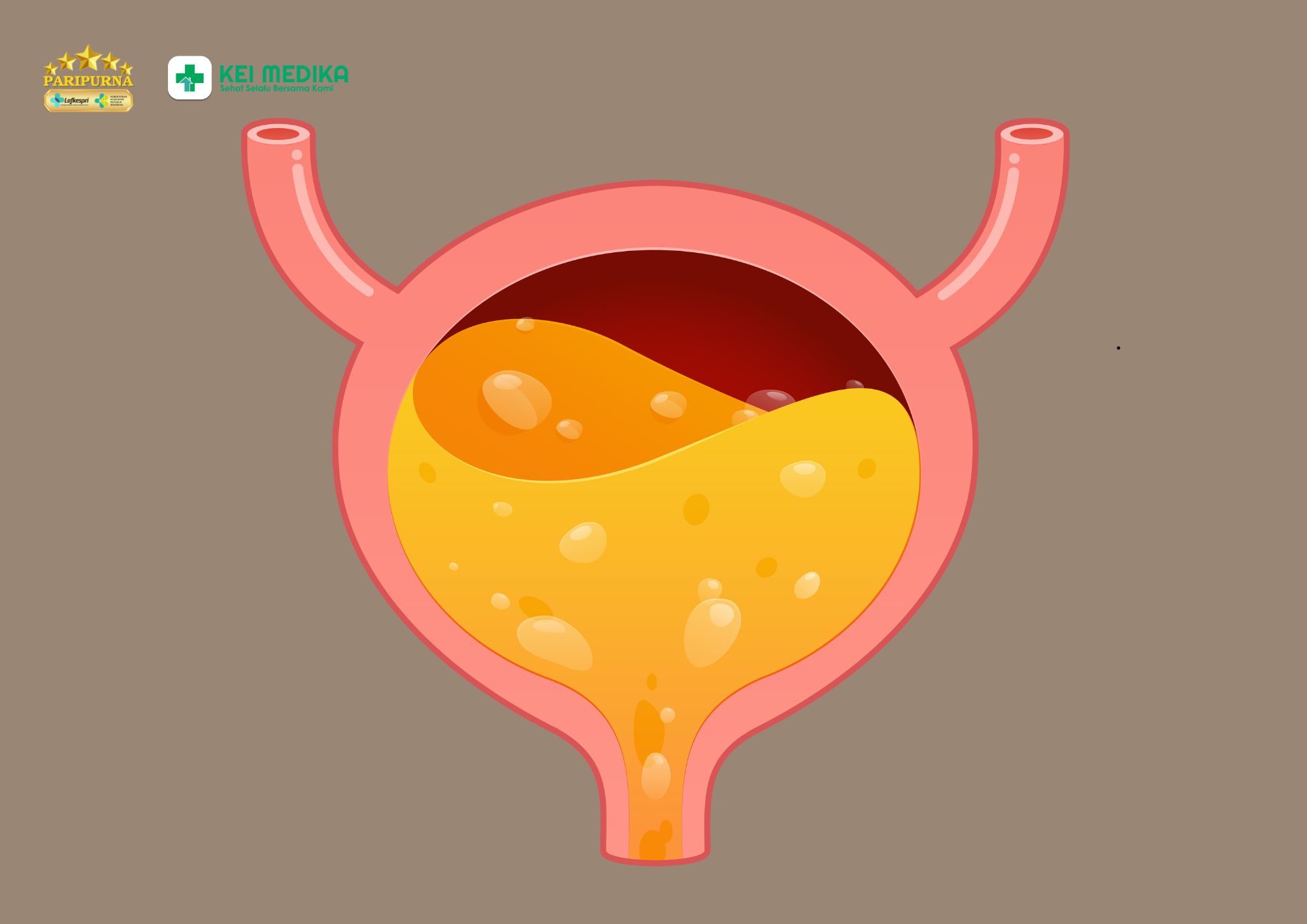 Urine Berbusa Terus-Menerus, Apakah Bisa Menjadi Tanda Gangguan Ginjal?