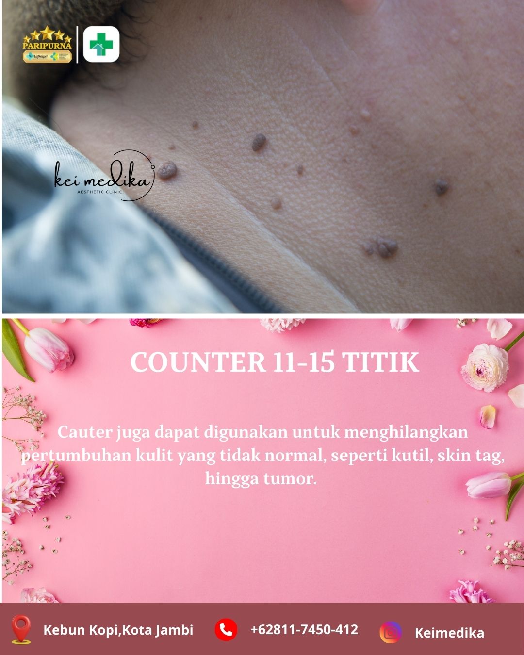 COUNTER 11-15 TITIK