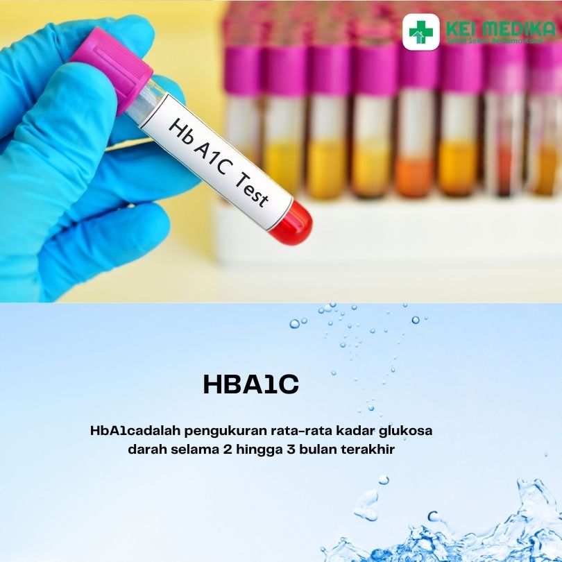 HBA1C