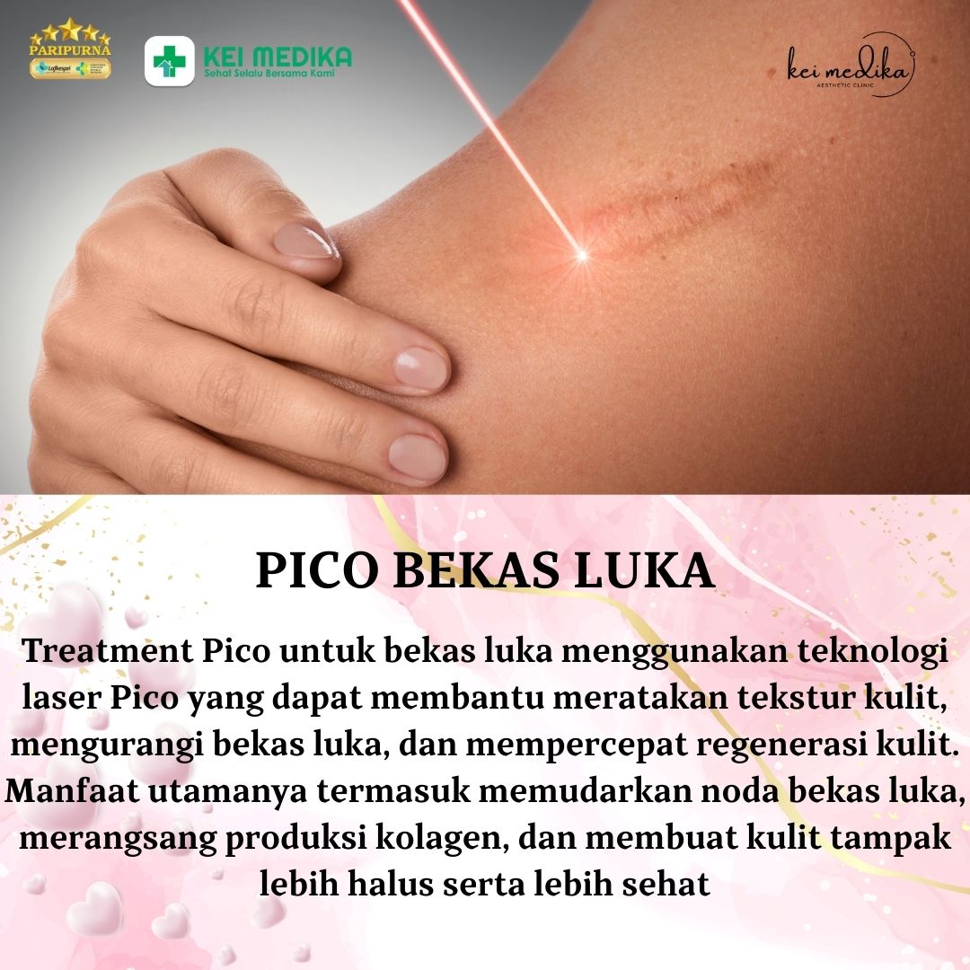 PICO BEKAS LUKA
