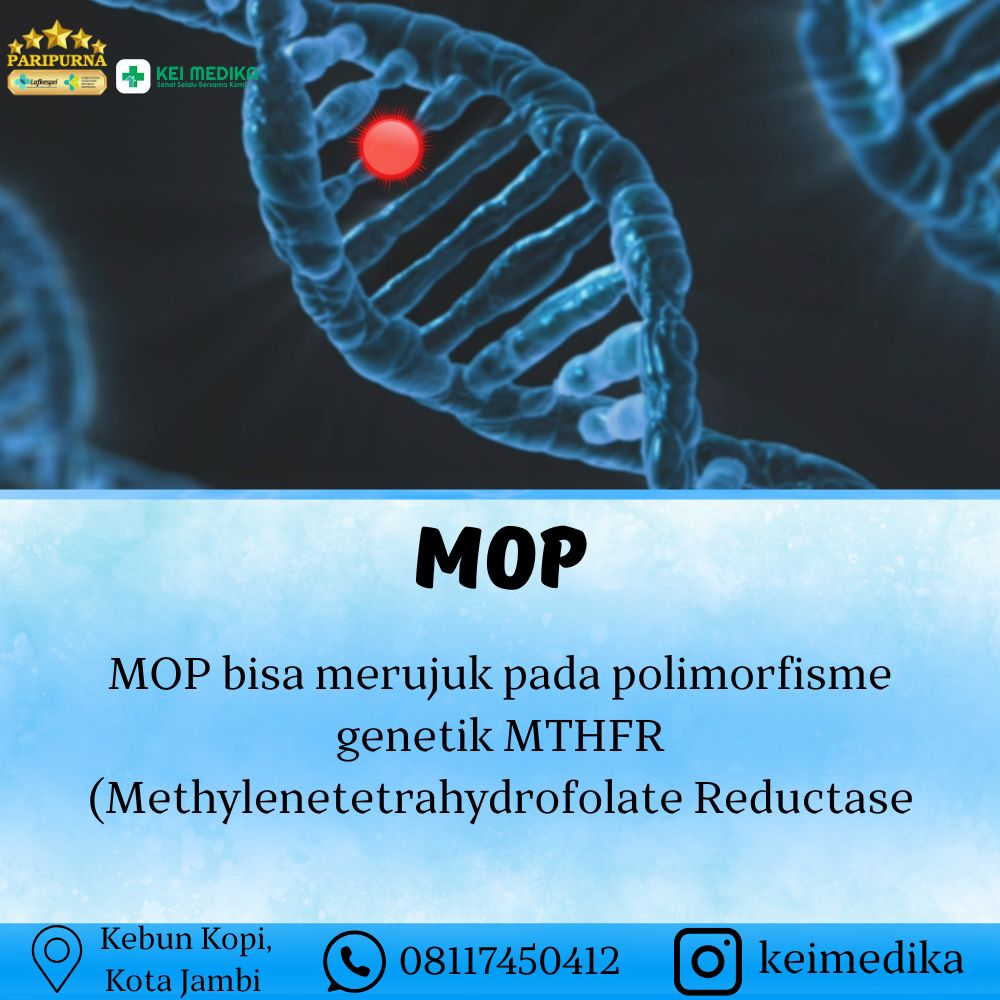 MOP