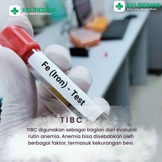 TIBC