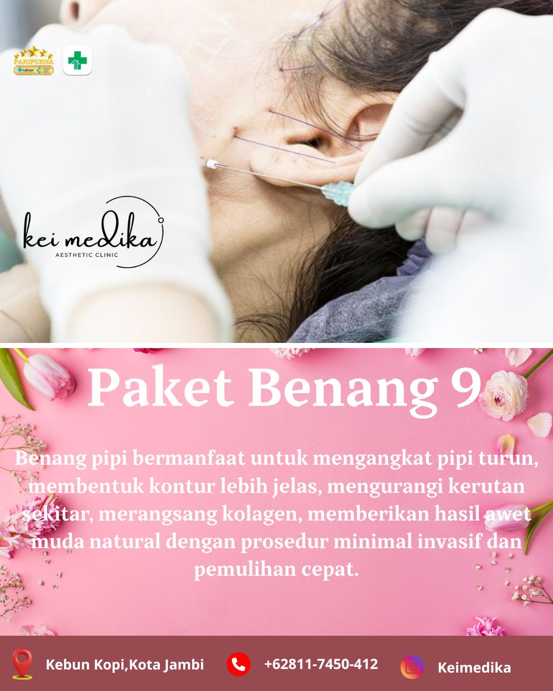 PAKET BENANG 9