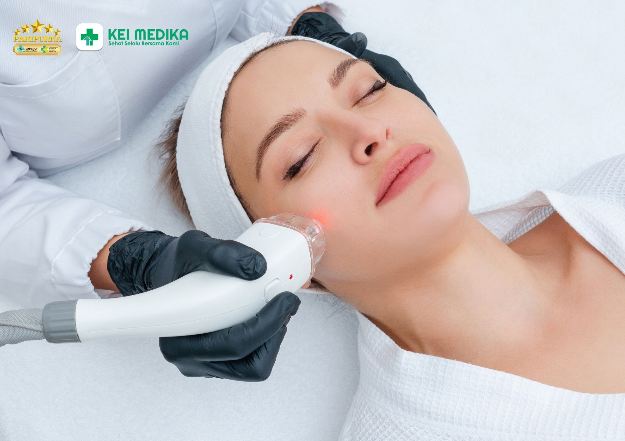 Perawatan kulit wajah dengan laser fractional