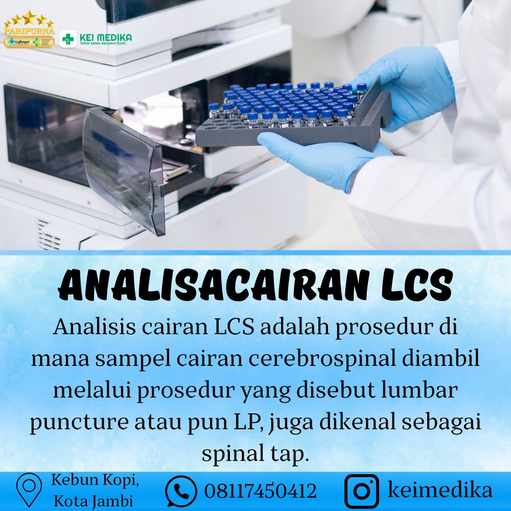 ANALISACAIRAN LCS