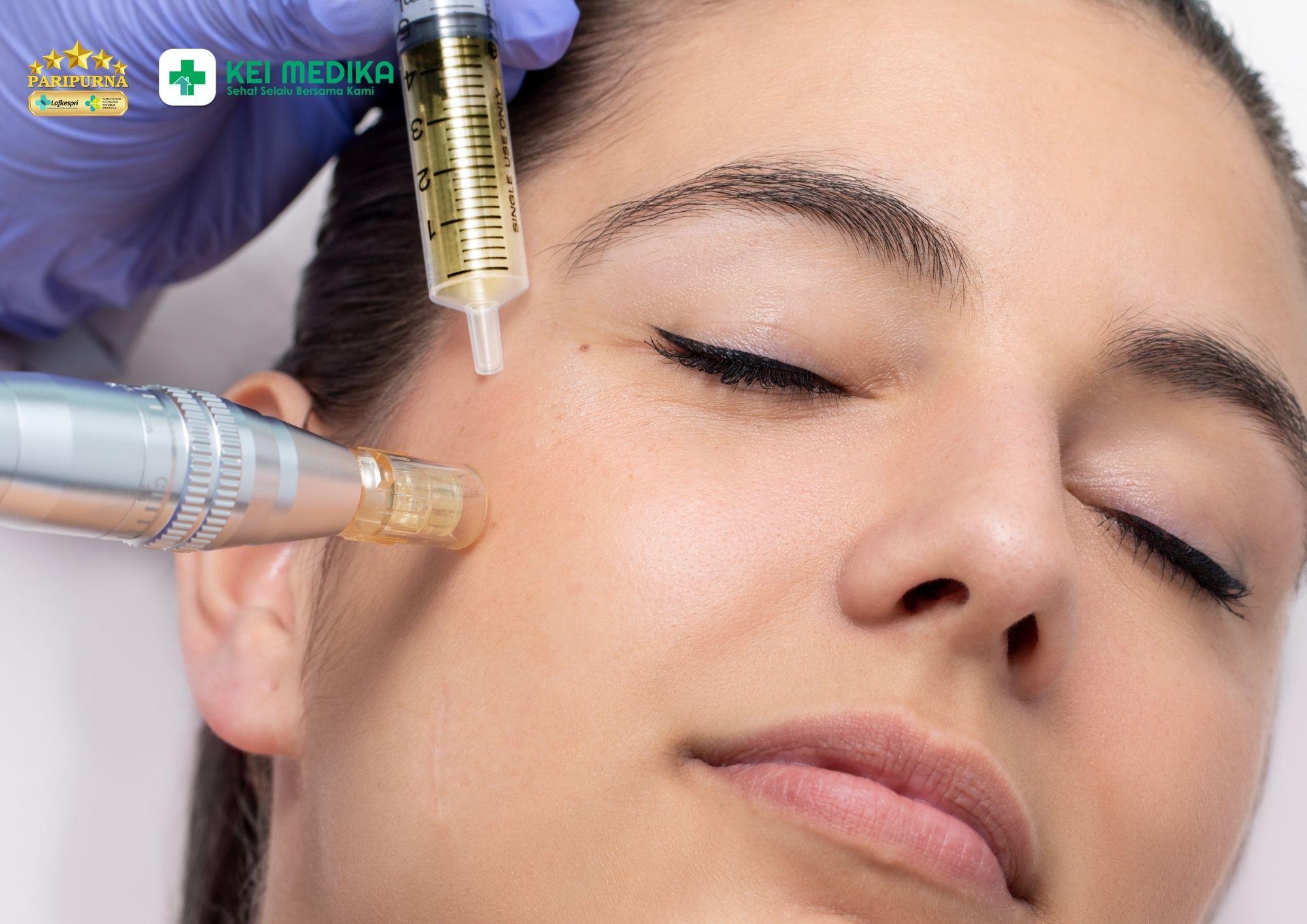 Derma scar treatment untuk keloid dan hipertrofik