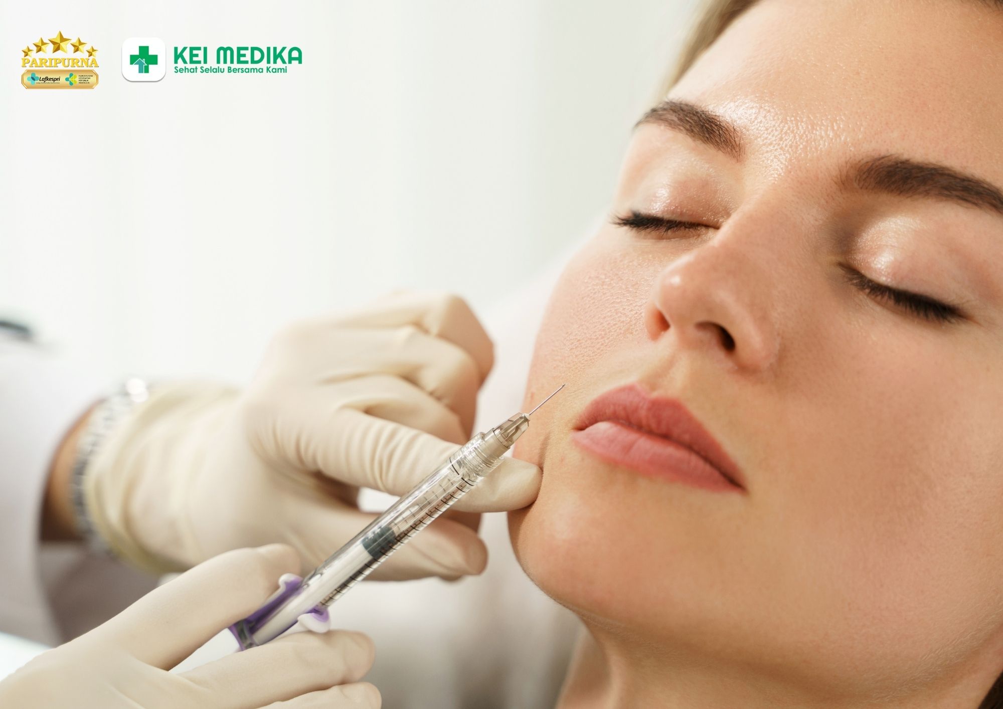 Filler: Cara Instan Membentuk Hidung, Pipi, dan Dagu Tanpa Operasi