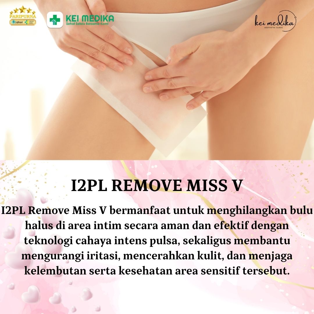I2PL REMOVAL MISS V