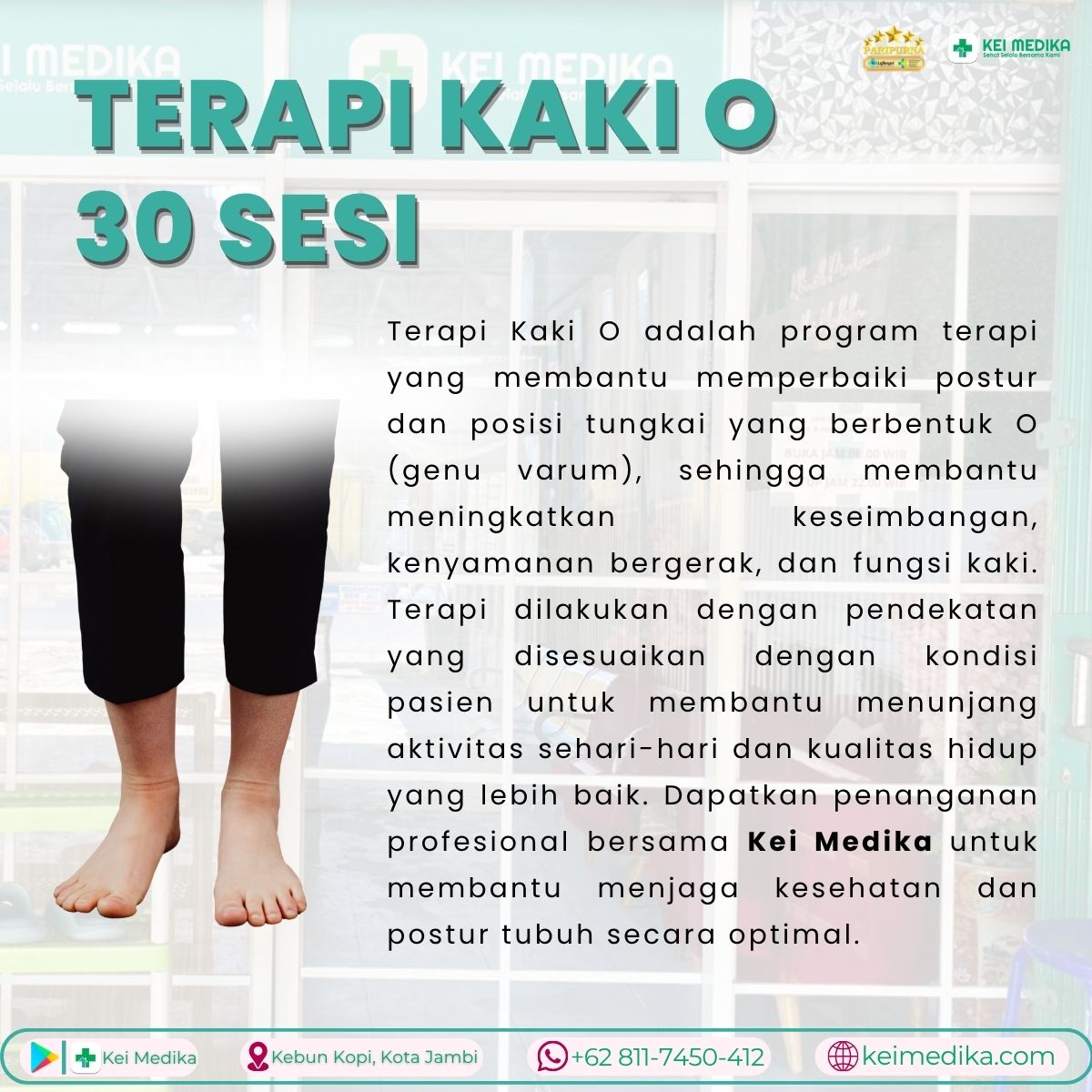  FISIOTERAPI KAKI O 30 SESI (FREE KONSULTASI 2X)