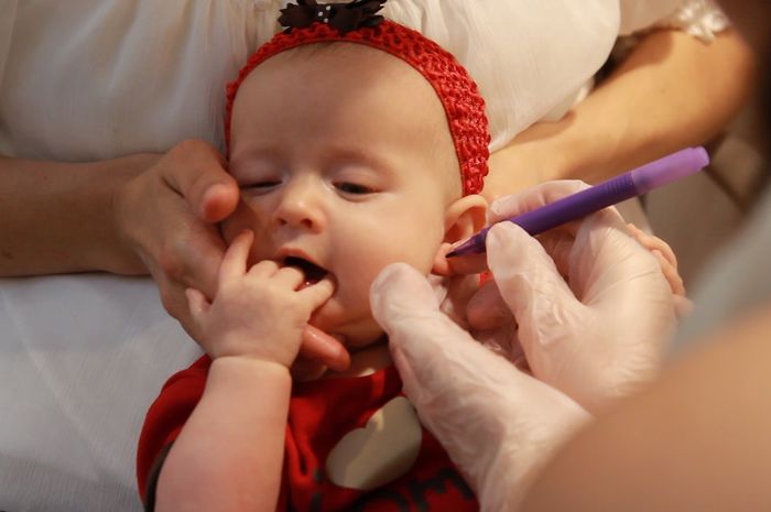 kapan waktu yang tepat melakukan tindik pada bayi Perempuan?