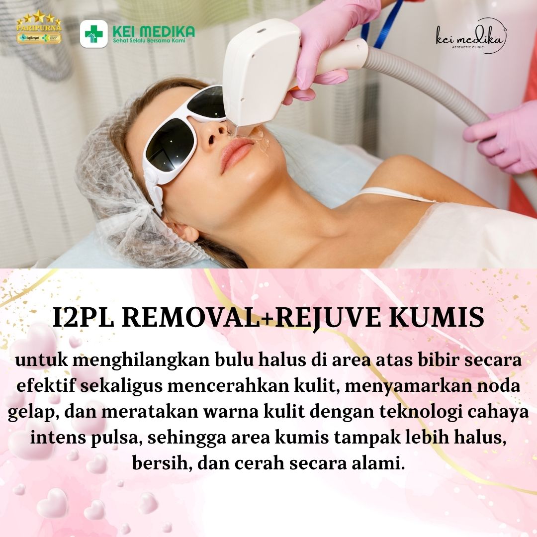 I2PL REMOVAL+REJUVE KUMIS