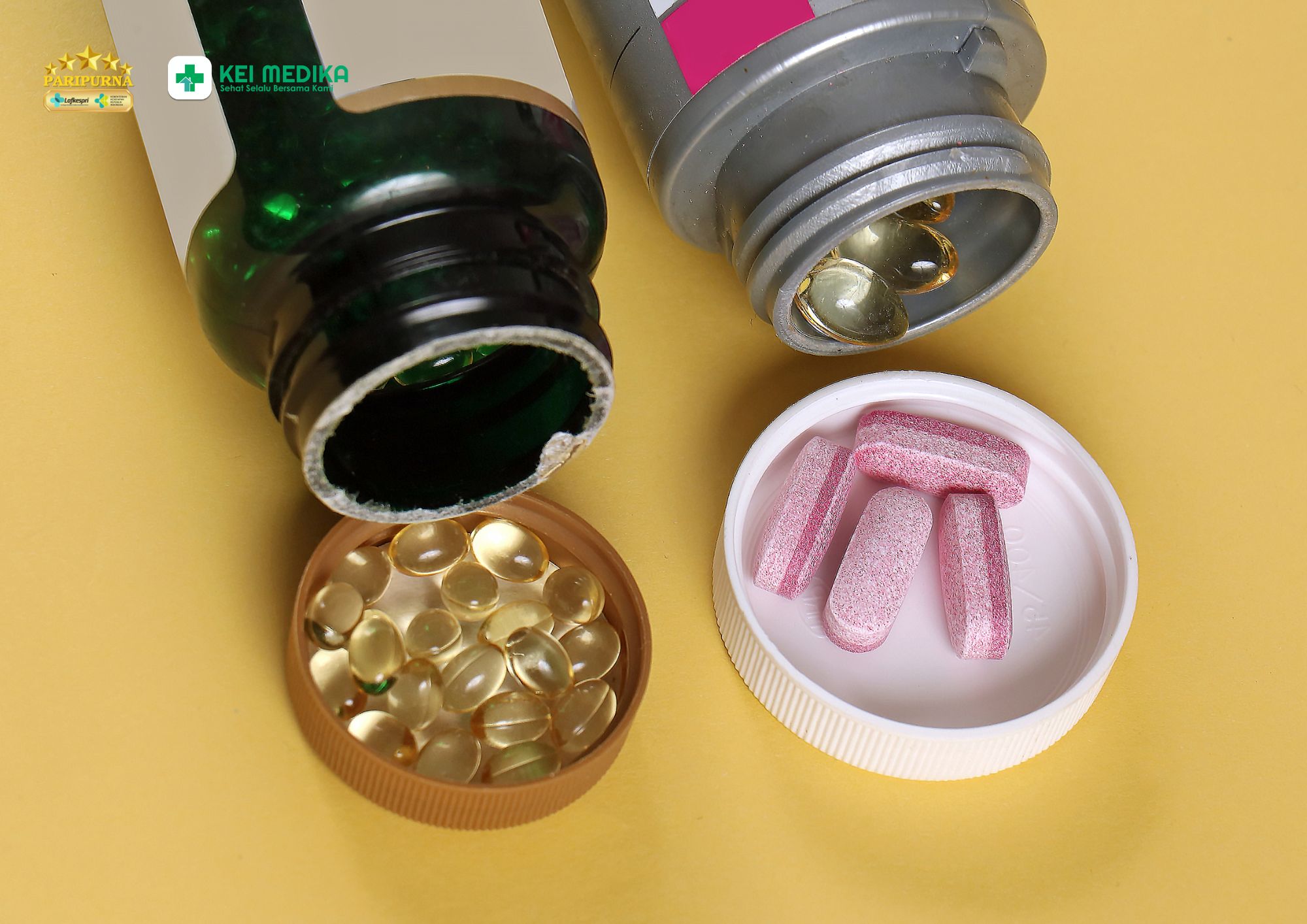 Suplemen Zat Besi dan Multivitamin, Bolehkah Diminum Bersamaan?