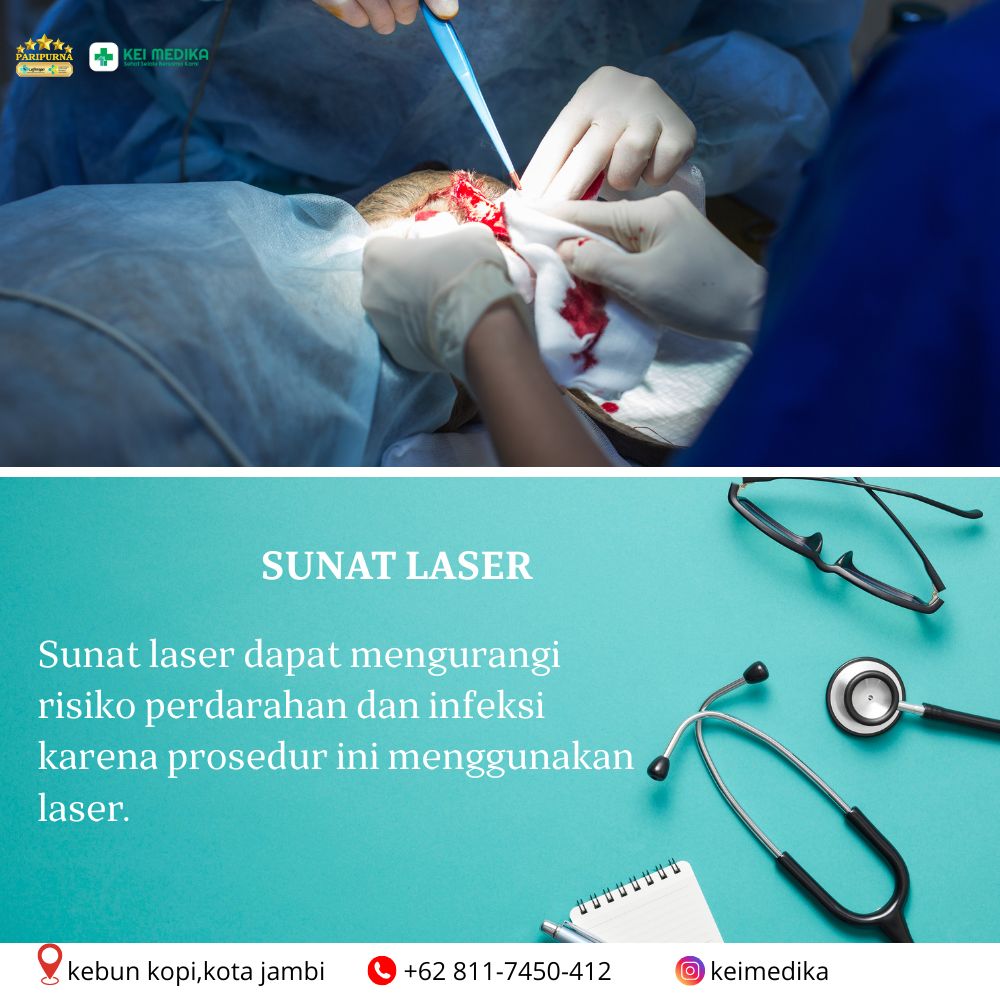 SUNAT LASER 