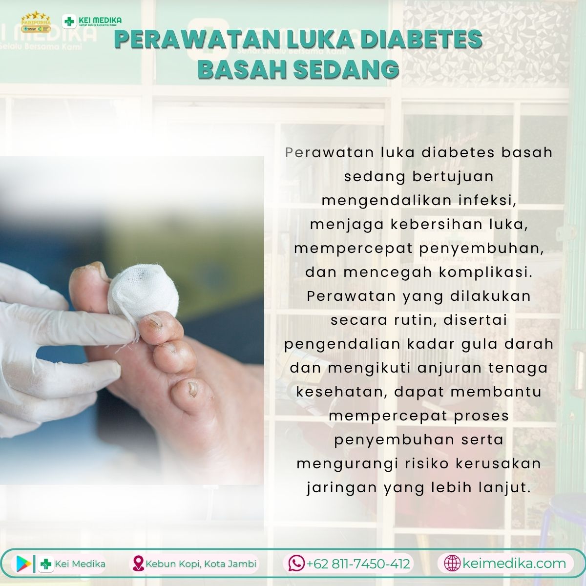  PERAWATAN LUKA DIABETES BASAH SEDANG 