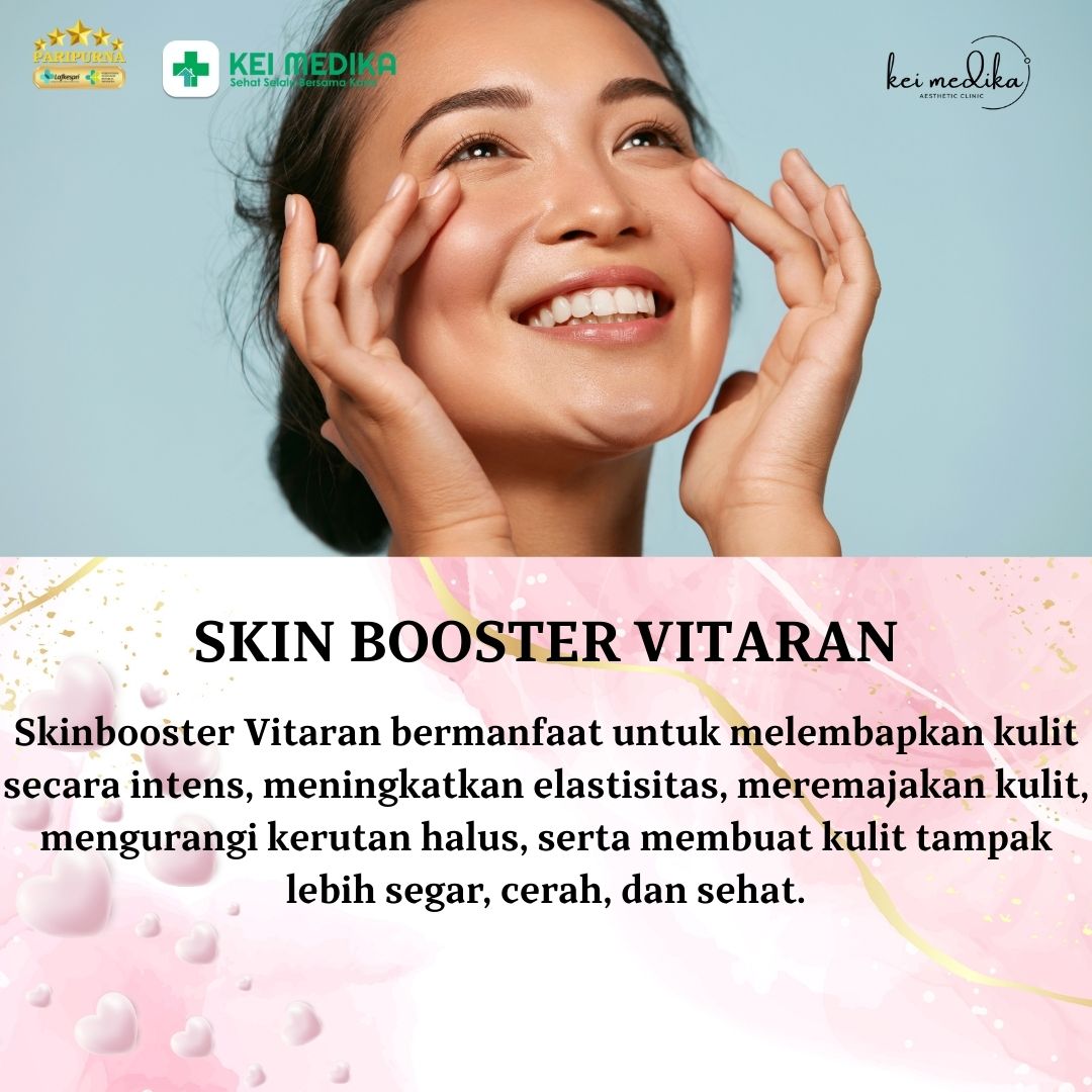 SKIN BOOSTER VITARAN 