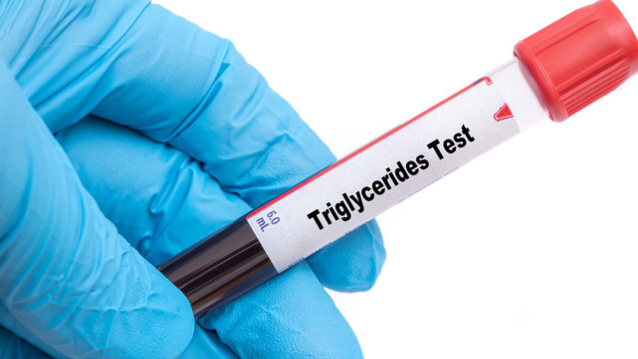 TRIGLISERIDA 