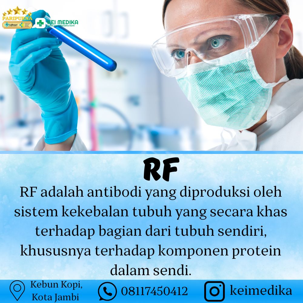 RF 