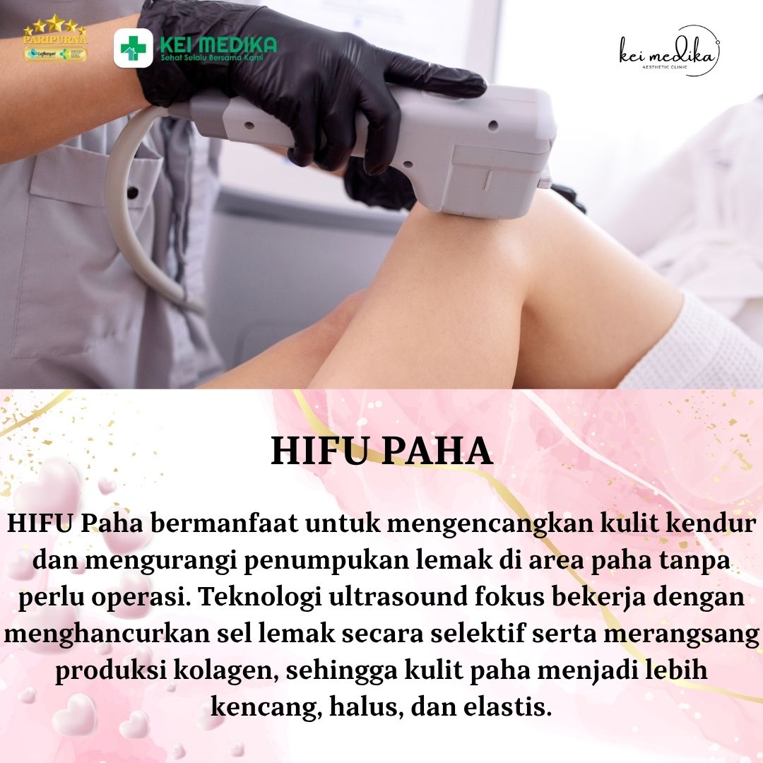 HIFU PAHA