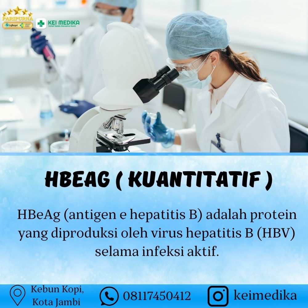 HBEAG ( KUANTITATIF ) 