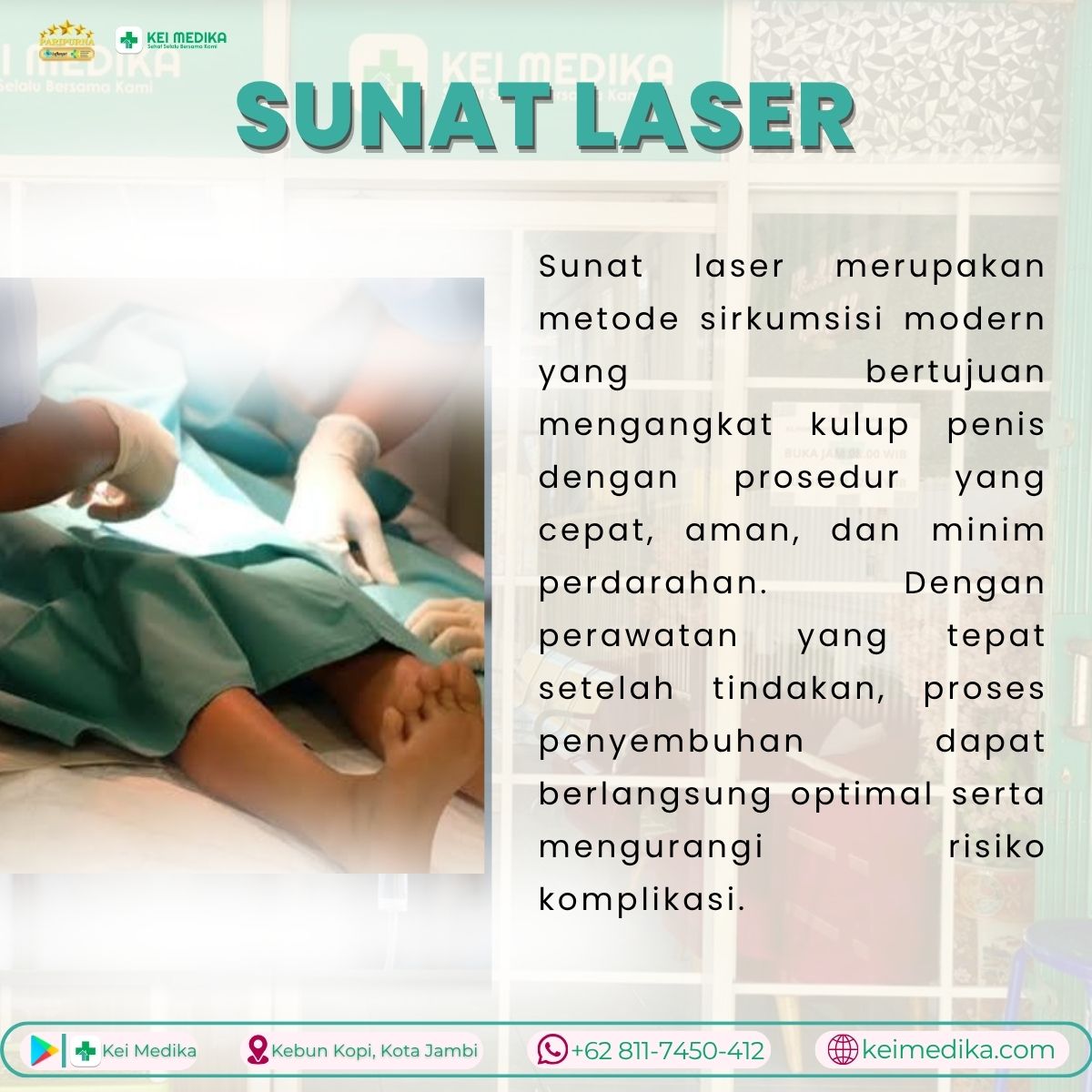 SUNAT LASER 
