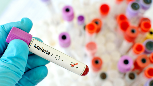 Pemeriksaan Malaria