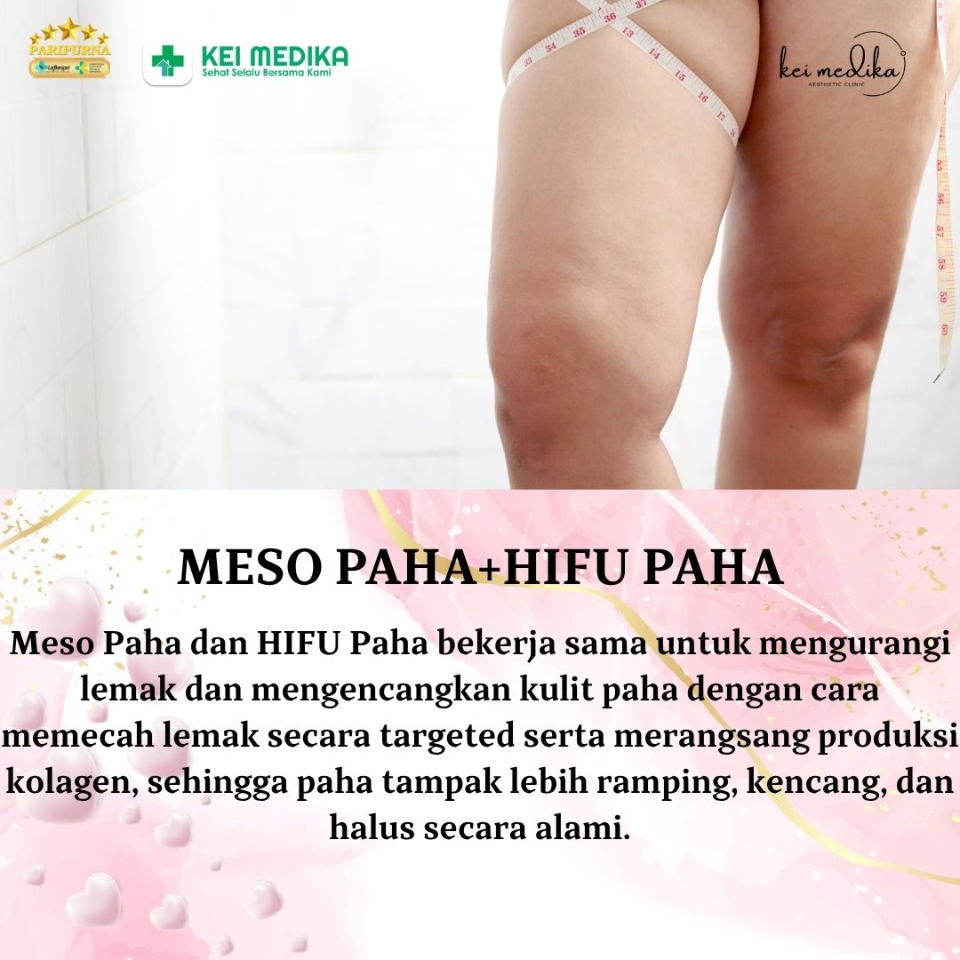 MESO PAHA+ HIFU PAHA