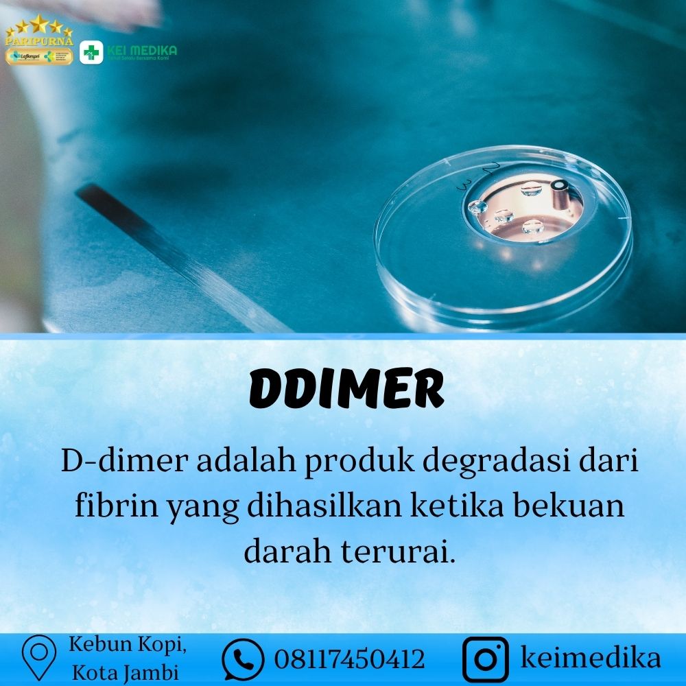 DDIMER