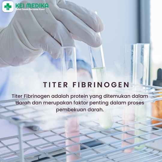 TITER FIBRINOGEN
