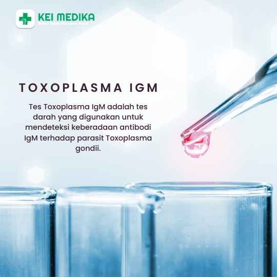TOXOPLASMA IGM 
