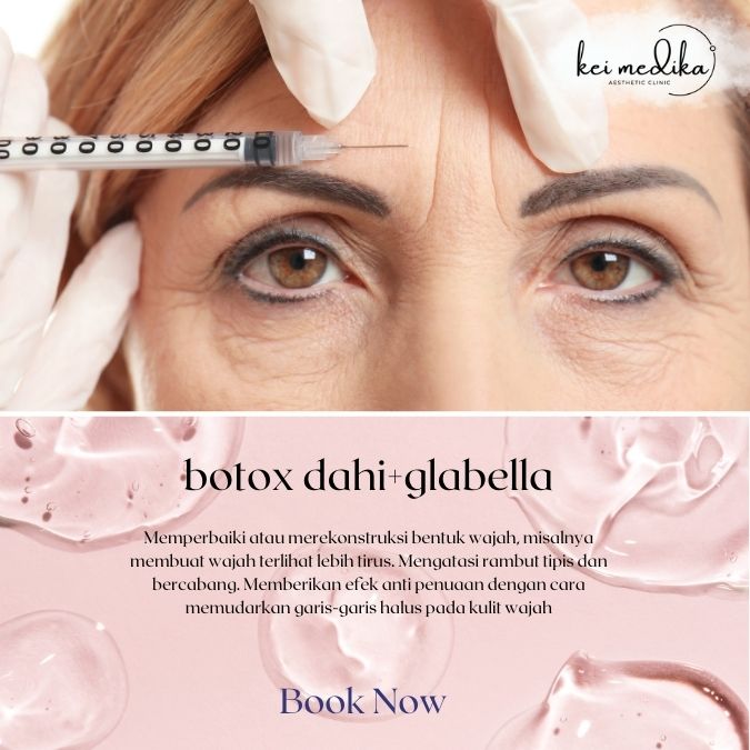 botox dahi+glabella