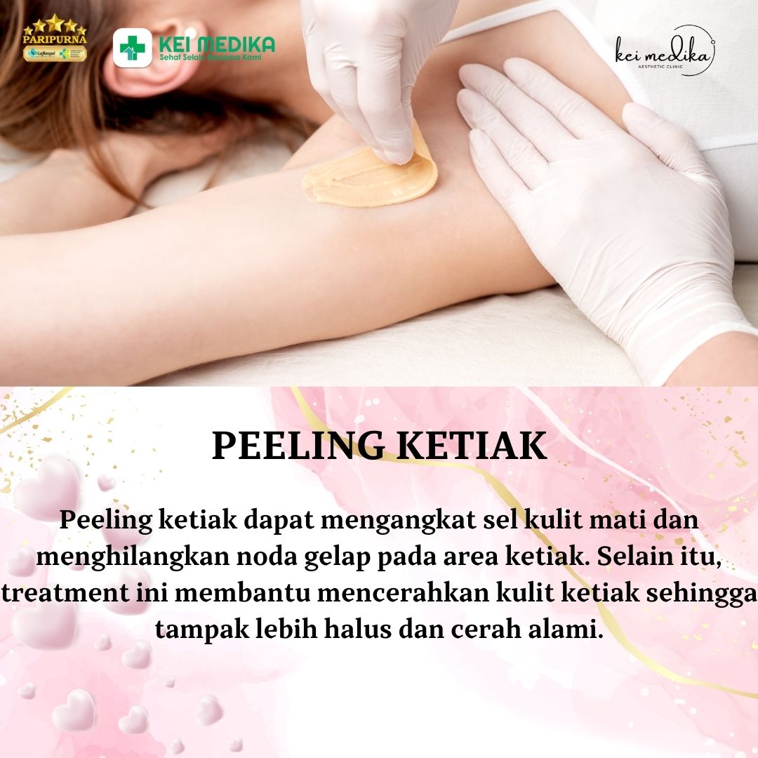 PEELING KETIAK