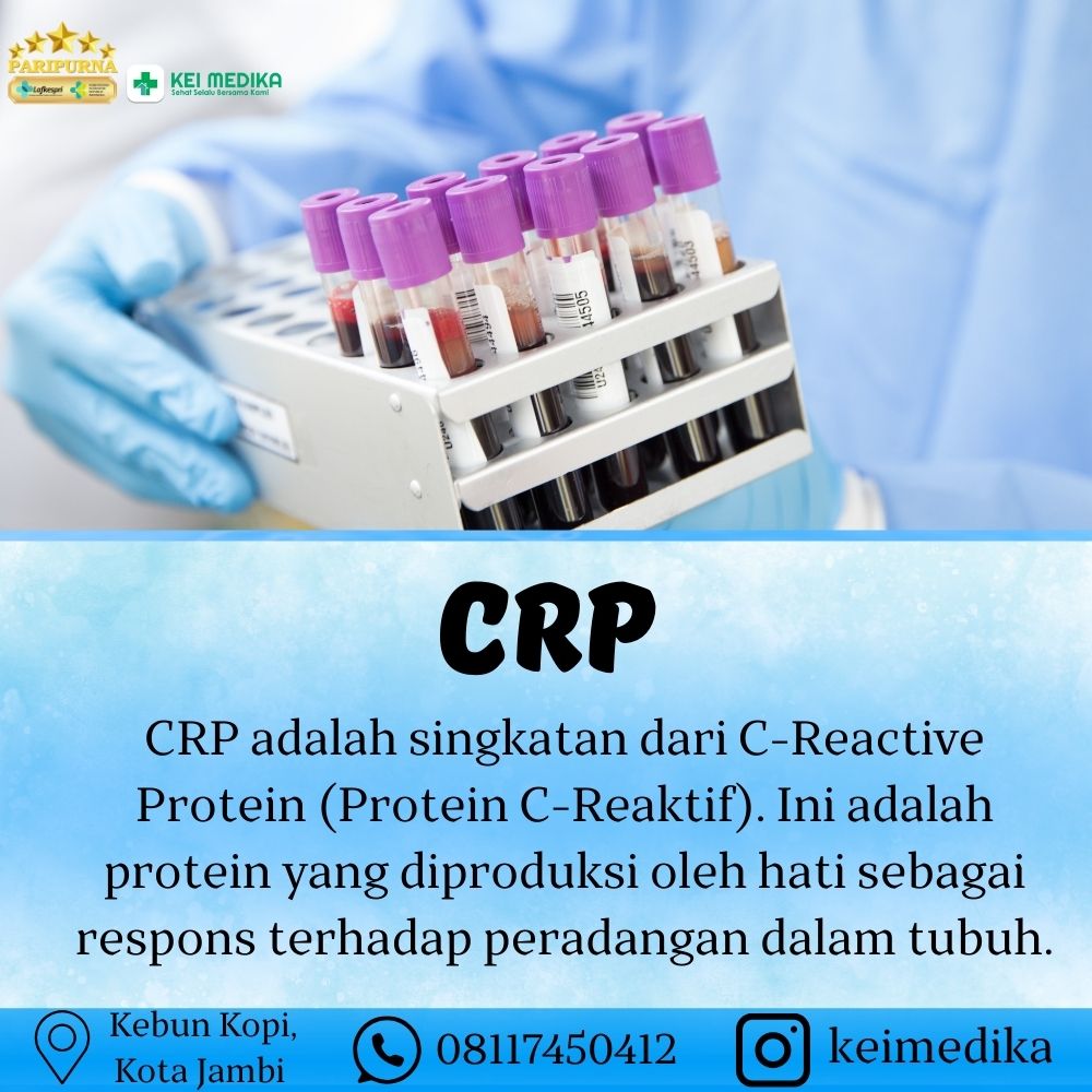 CRP