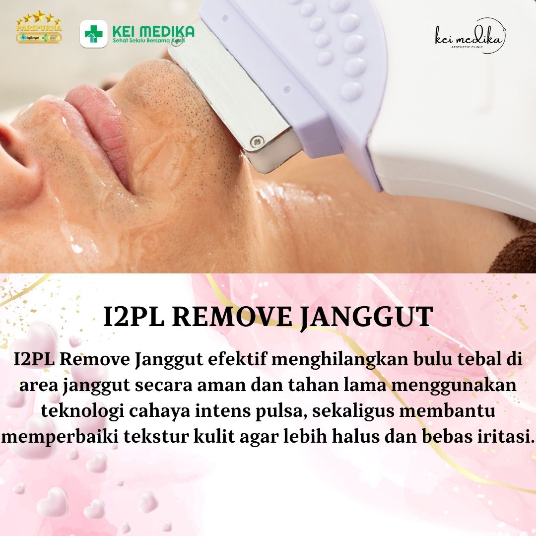 I2PL REMOVAL JANGGUT