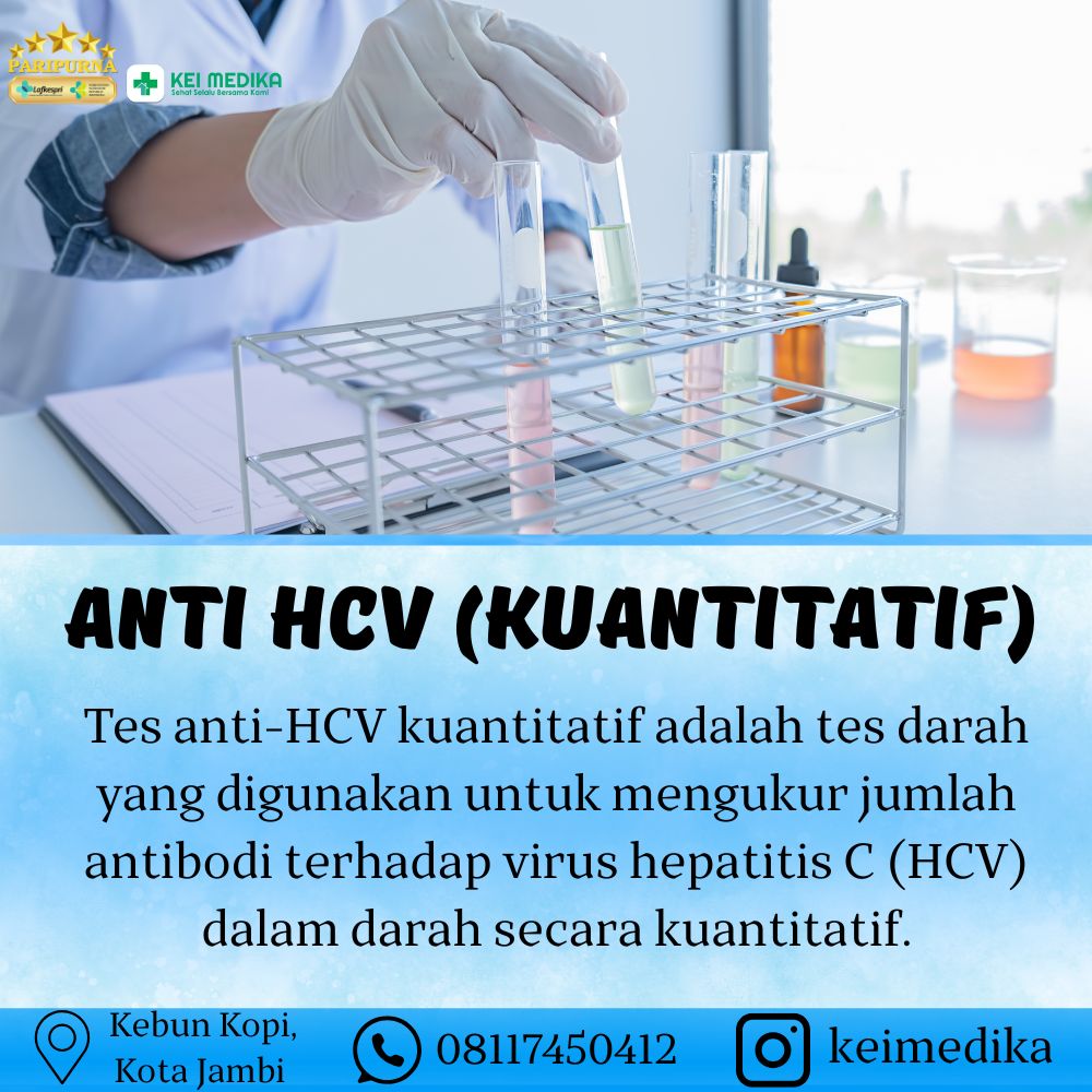 ANTI HCV (KUANTITATIF)