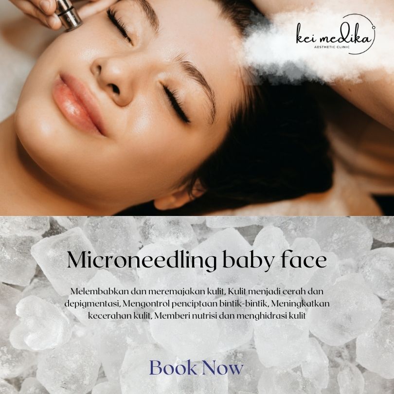 microneedling baby face