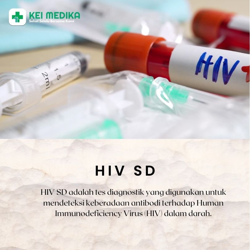 HIV SD