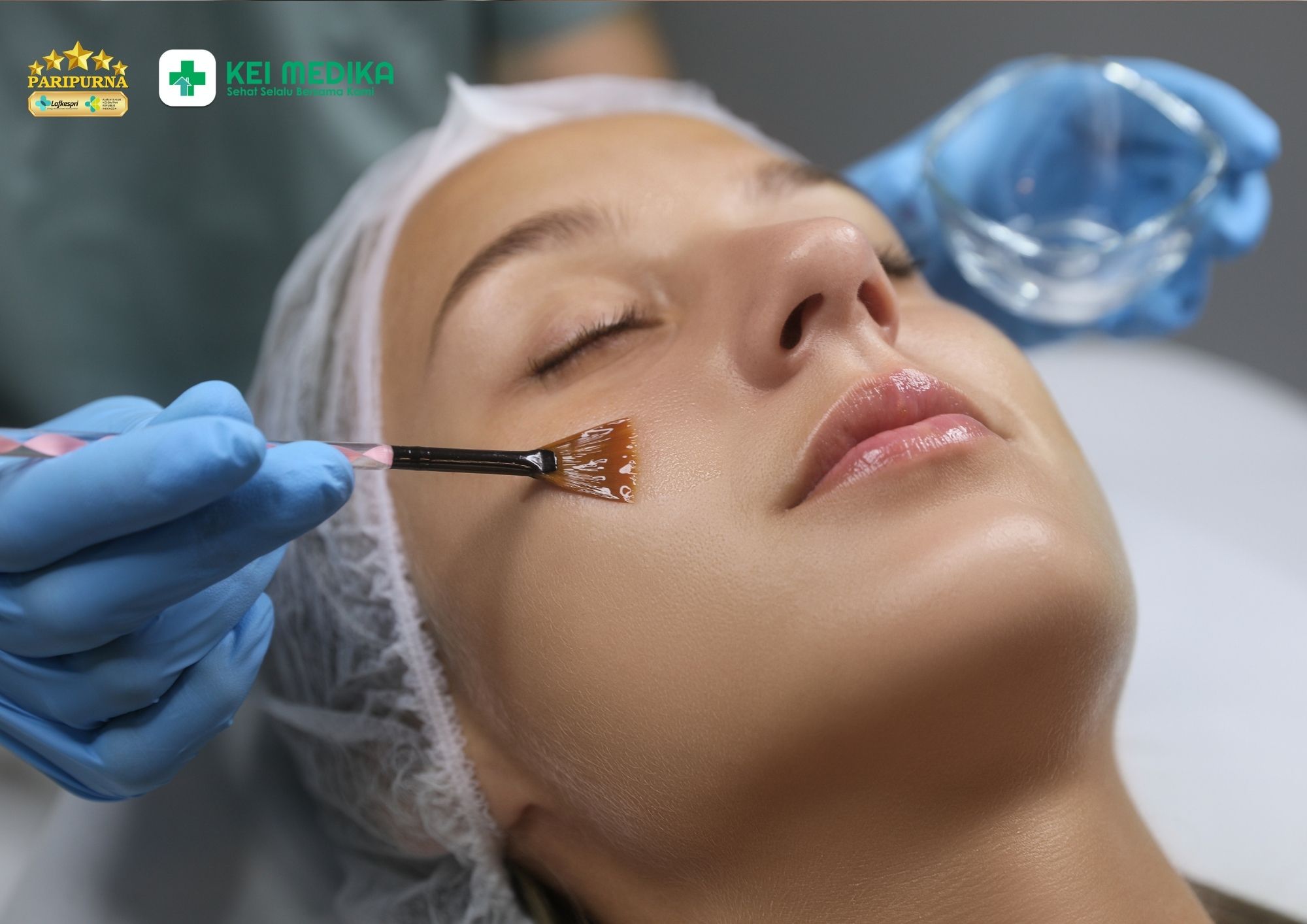Peeling AHA dan manfaatnya untuk kulit cerah
