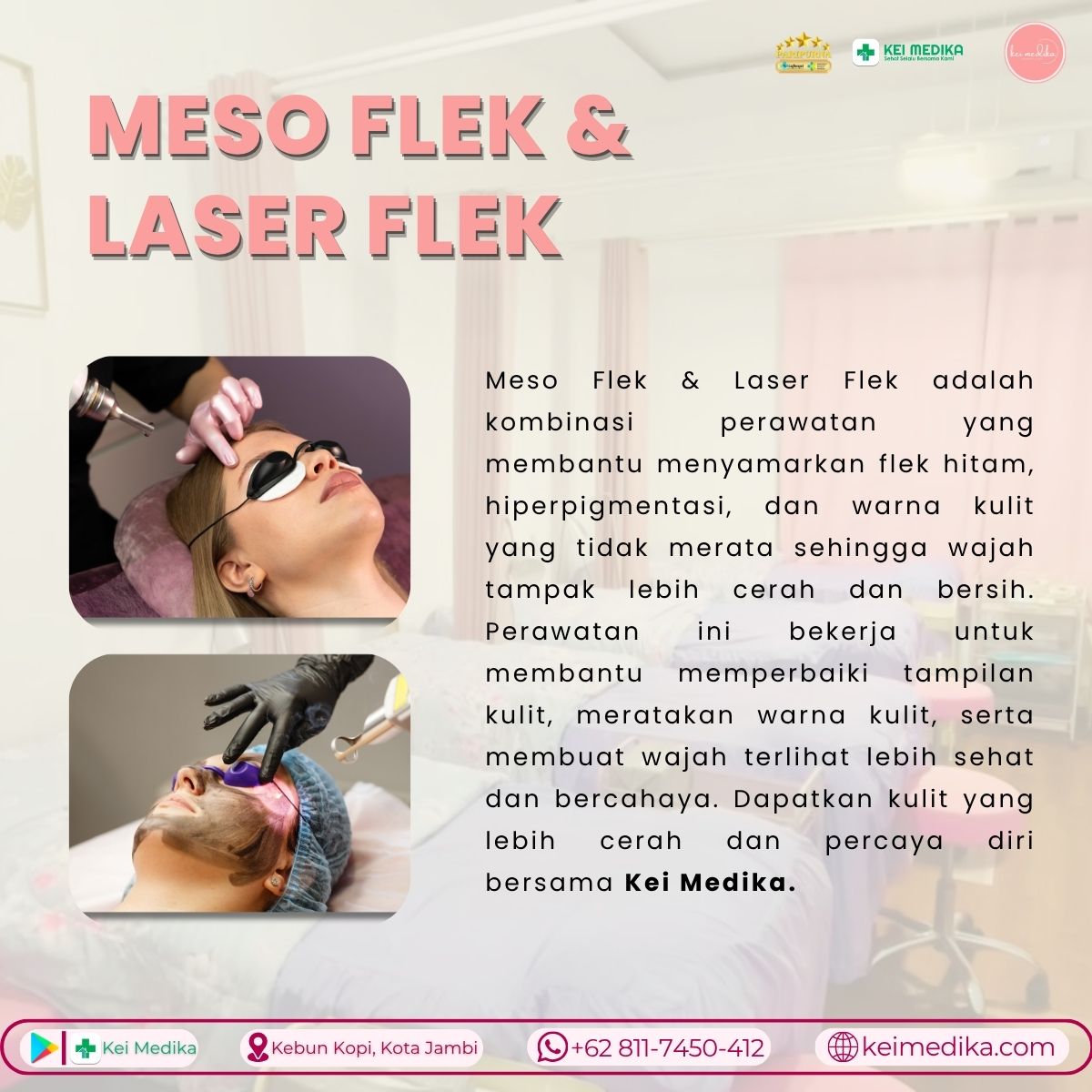 MESO FLEK DAN LASER FLEK