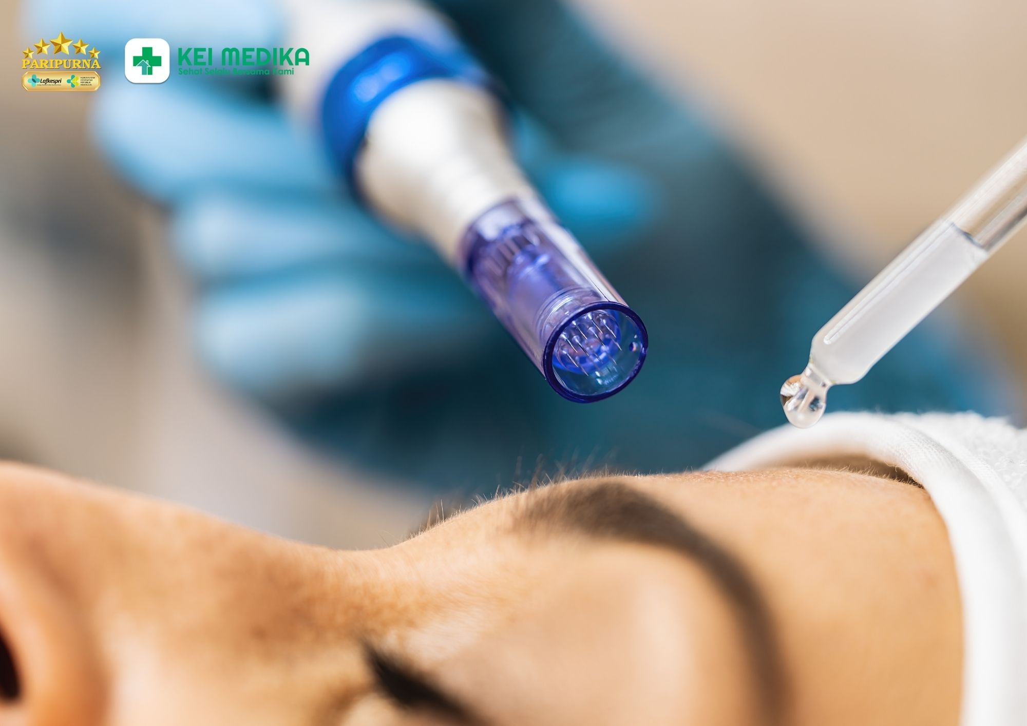 Derma PRP dan manfaatnya untuk kulit glowing