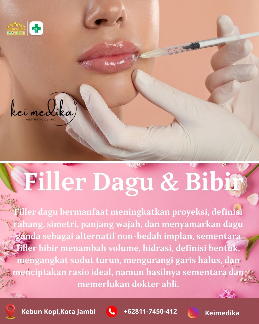FILLER DAGU+BIBIR