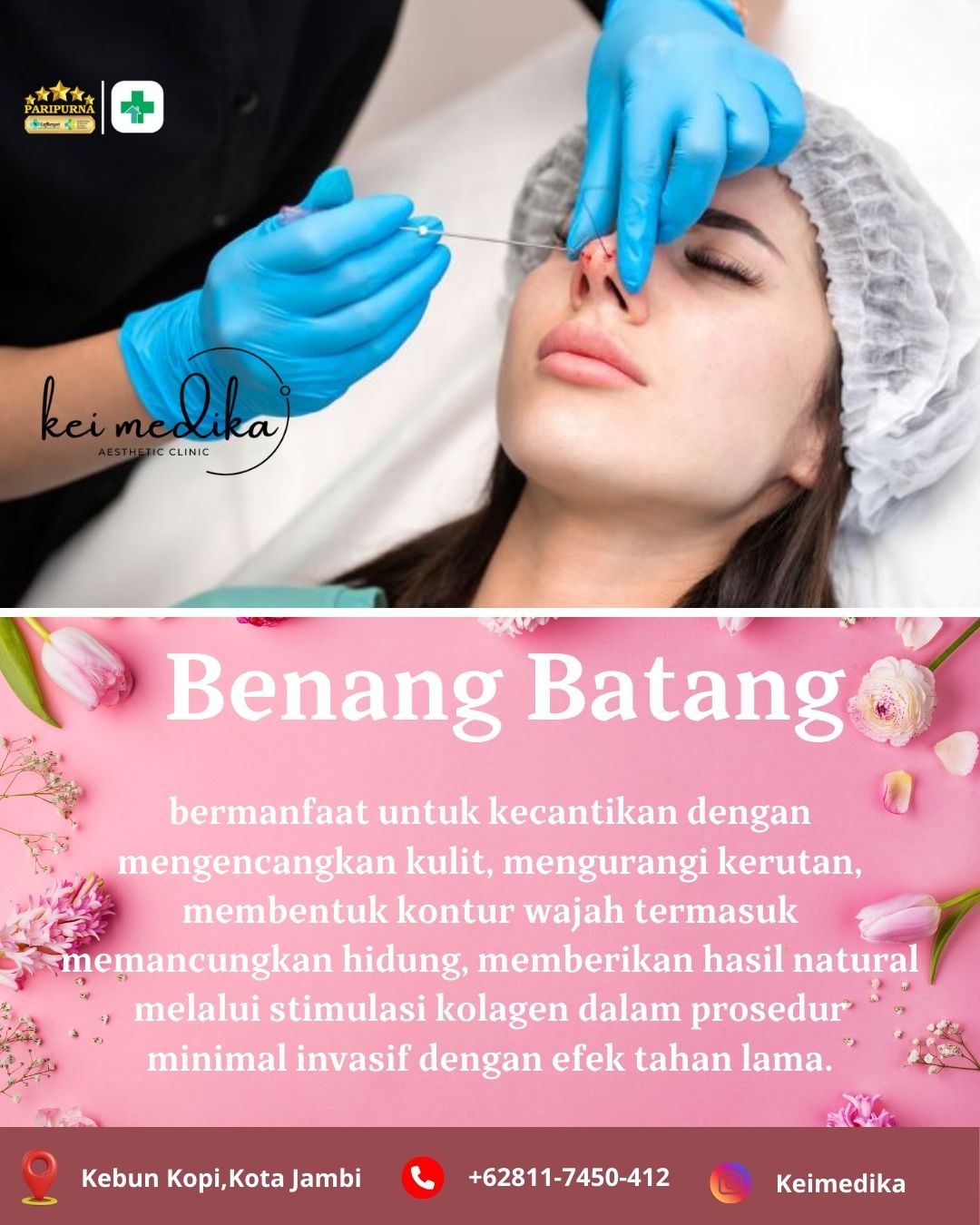 BENANG BATANG